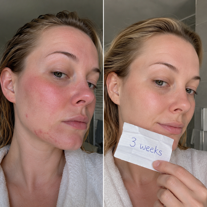Glow Filter Showerhead — Oil+ Vitamin C K-Beauty Ritual