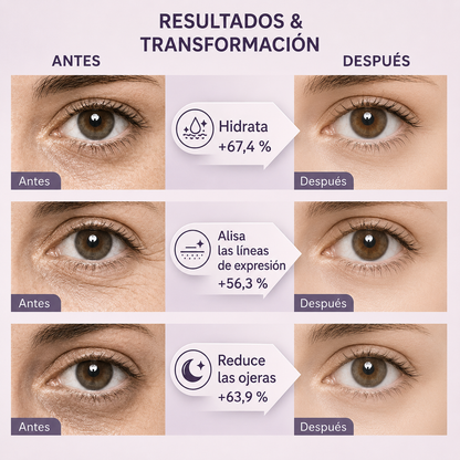 Parches Ojos 360° — Biocolágeno, Péptidos & Vitamina C